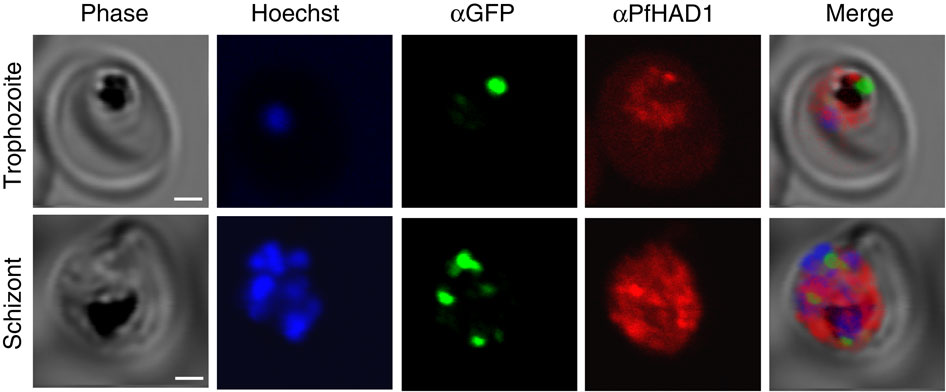 PfHAD1 is expressed in blood-stage parasites and is localized to the parasite cytoplasm. Immunofluorescence confocal microscopy of ​ACPL-GFP trophozoite and schizont37, stained with αGFP and α​PfHAD1 antibodies and ​Hoechst 33258 nuclear stain. Scale bars, 2 μm.  A sugar phosphatase regulates the methylerythritol phosphate (MEP) pathway in malaria parasites.  Odom et al 2014.