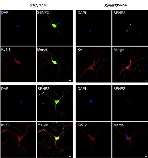 Hyper-SUMOylation of Kv1.1 and Kv7.2 in SENP2 fxN/fxN Neurons.  SENP2 colocalizes with Kv1.1 and Kv7.2 in hippocampal neurons. Neurons from the brains of SENP2+/+ and SENP2fxN/fxN mice were cultured for immunocytochemistry with SENP2 (green) and Kv1.1- (red) or Kv7.2 (red)-specific antibodies.  DAPI (blue) was used to show nuclei. Bars in all panels are 5 microns.  Yeh et al 2014. 
