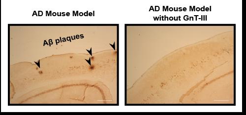 Immunostaining of Aβ plaques showed that while the normal mouse model for Alzheimer's disease displayed numerous Aβ plaques (left, black arrows), the number of plaques was significantly reduced when these mice lacked the GnT-III enzyme (right). Scale bar, 300 μm.  Credit:  RIKEN 2015. 