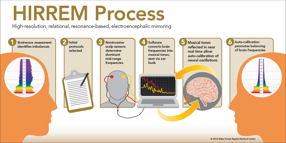 The HIRREM Process is summarized above,  High-resolution, relational, resonance-based, electroencephalic mirroring (HIRREM®), developed by Lee Gerdes and Brain State Technologies, LLC, is a noninvasive, brain feedback technology to facilitate relaxation and auto-calibration of neural oscillations by using auditory tones to reflect brain frequencies in near real time (Gerdes L, et al., Brain Behav, 2013).   Credit:  Wake Forest Baptist Medical Center 2015.