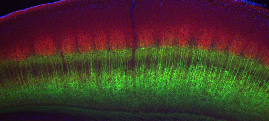  Controlling the flood of information The cortex sends 10 times as many axons from its neurons (green) into the thalamus as the thalamus sends from its neurons (red) into the cortex. Cortical neurons control the activity of thalamic neurons by varying the frequency of their signals. Connors lab/Brown University 