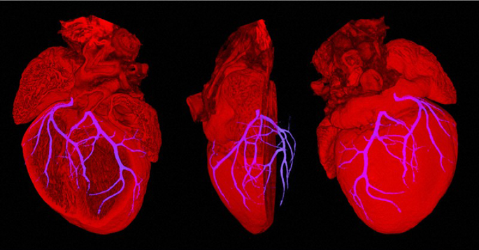 Composite image showing an embryonic heart from a mouse embryo at stage E18.5. The coronary circulation is crucial to the hearts function as it provides blood to the thick muscle tissue of the heart itself. These coronary arteries are very small and difficult to image using standard techniques, they are normally observed by injecting the coronary circulation with a dye and using x-rays to image.  High Resolution Episcopic Microscopy (HREM).  Credit: NIMR, MRC. Wellcome Images.