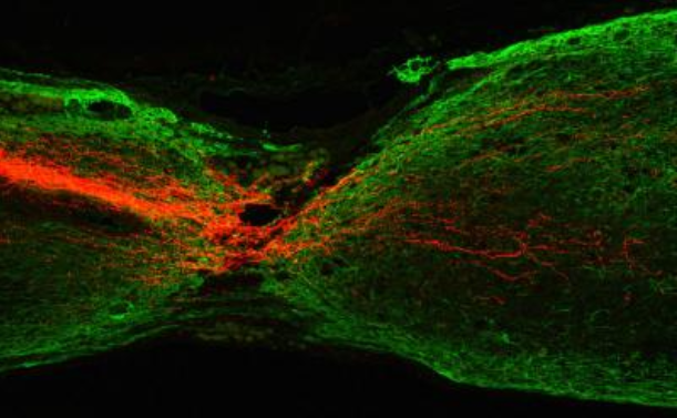 Regeneration of Mouse Corticospinal Tract Axons.  This sagittal section shows the regeneration of mouse corticospinal tract axons (red) 7 months after Pten deletion was initiated in motor cortex. Pten deletion was initiated 1 year after spinal cord injury in this mouse. Green labels glial fibrillary acidic protein.  Credit:  Division of Life Science, HKUST. 