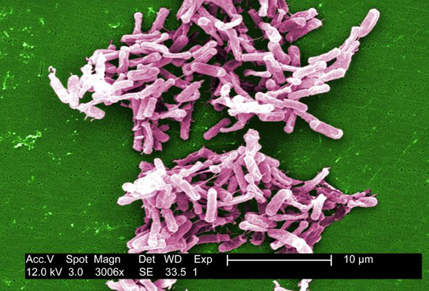 Gram-positive C. difficile bacteria from a stool sample.  Credit:  Photo by Janice Carr, Centers for Disease Control.      
