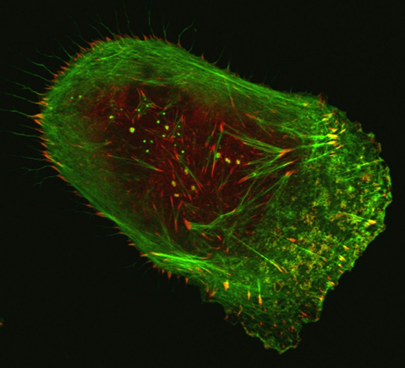 Human malignant melanoma cell viewed through a fluorescent, laser-scanning confocal microscope. Invasive structures involved in metastasis appear as greenish-yellow dots, while actin (green) and vinculin (red) are components of the cell’s cytoskeleton.  Credit: Vira V. Artym, National Institute of Dental and Craniofacial Research, NIH.