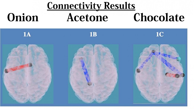 This figure presents the different connections found for the normal weight vs. obese children depending on smell: onion (1A), acetone (1B) and chocolate (1C). The red lines correspond to connections which were larger for normal weight vs. obese children. The blue lines correspond to stronger connections between the normal weight vs. obese children.  Credit: Radiological Society of North America. 