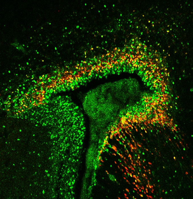 The autism-linked protein MDGA1 (red) is found in the zones of the brain that give rise to new neurons (green).  Credit: Salk Institute.