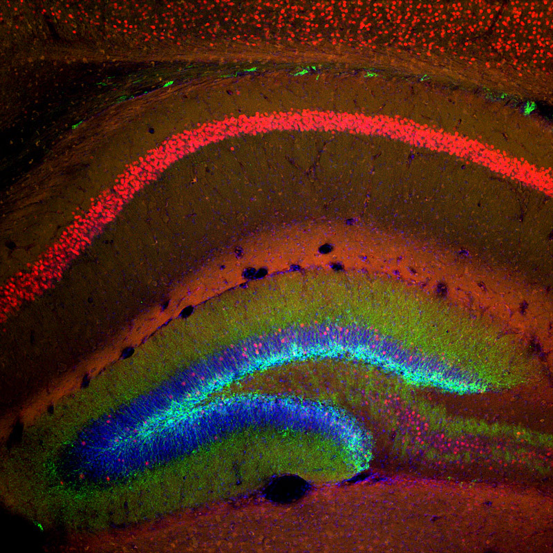 Functional Neurogenesis.  Doublecortin + zif268 in a young mouse brain.  Credit: Jason Snyder.