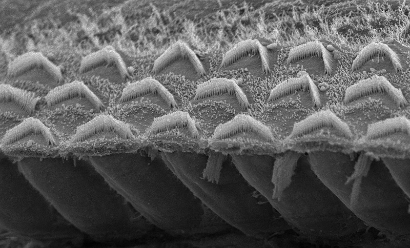 The inverted V’s above are sensory hair bundles in the ear, each containing 50 to 100 microvilli tipped with TMC proteins. (Gwenaelle Geleoc & Artur Indzhykulian).