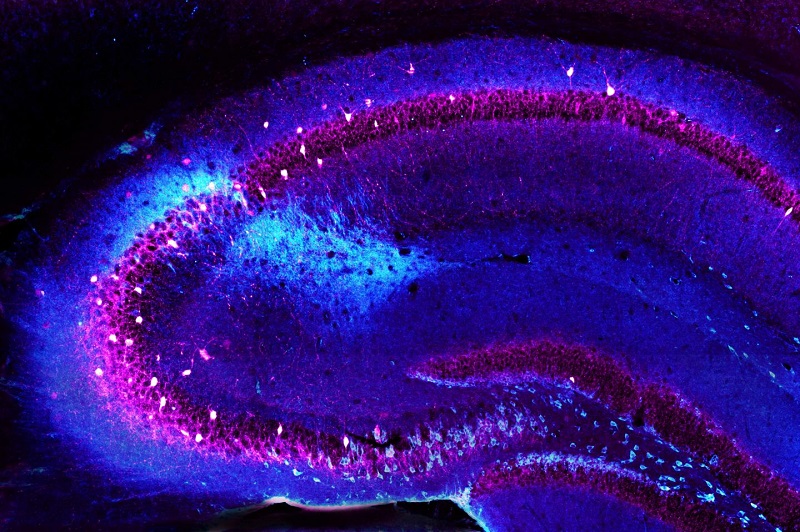 This is a mouse hippocampus with the CA2 region stained light blue. In the researchers' mouse model of schizophrenia, this region showed significant depletion of CA2 inhibitory neurons (shown here as white/magenta spots) and was accompanied by a deficit in social memory. Credit: Vivien Chevaleyre. 