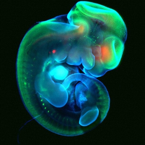 Image of a mouse embryo, different cell types shown by different colors [Image: B0008305 Mouse embryo under a CC BY-NC-ND 2.0 license].