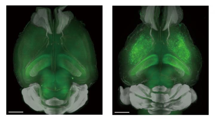 The research group used genetically engineered mice that expressed a green fluorescent protein when neural activity increases to monitor brain activity. (Left) Low-level neural activity during sleep without inhibition of NMDA receptors, a type of ion-channel protein found on the membrane of neurons. (Right) One important discovery was that in contrast to conventional theory, inhibiting NMDA receptors directly evokes neural activity and brings about waking. Copyright: Ueda lab. 