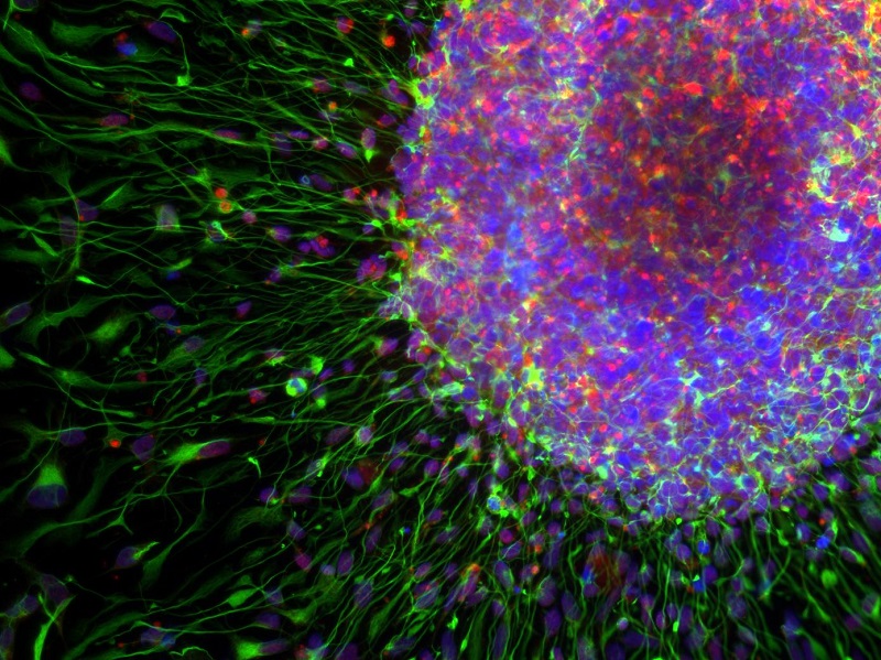 Neural Progenitor cells.  Credit: Prof Chandran lab.