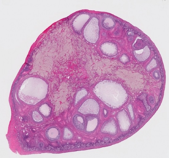 This cross-section of a human ovary shows potential areas for stem cells -which can now be converted to oocytes - even in adult women; Credit: Shutterstock.