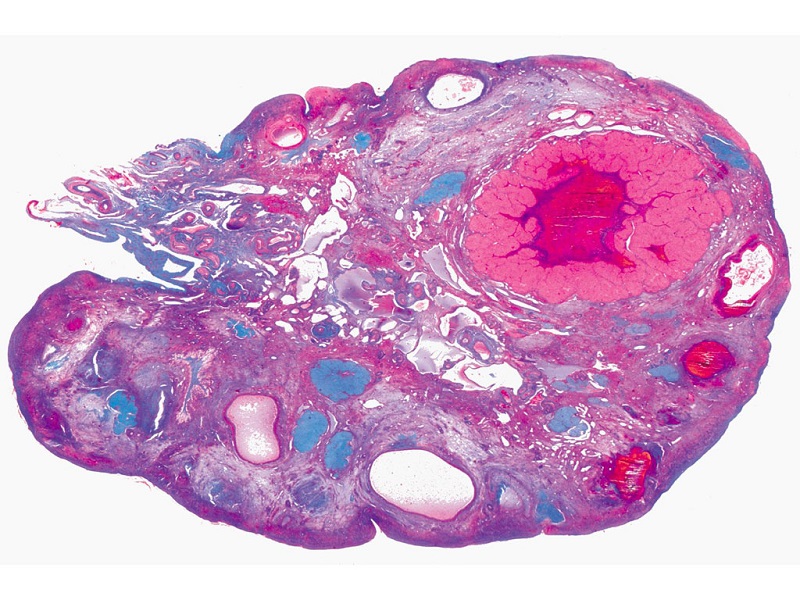 Human ovary by Yale Histology.