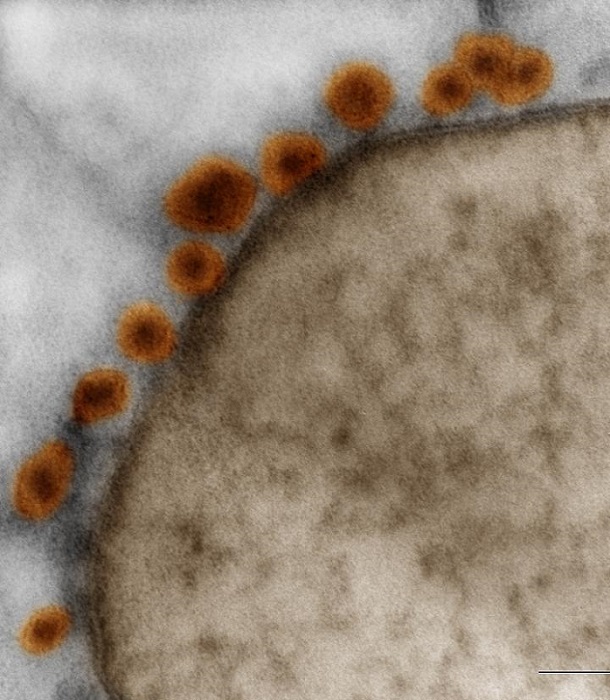 Electron microscopy of Zika virus (orange) bound to cell membrane (brown) in neurosphere generated from human iPS cells. This material relates to a paper that appeared in the 14 April, online issue of Science, published by AAAS. The paper, by P.P. Garcez at D'Or Institute for Research and Education (IDOR) in Rio de Janeiro, Brazil, and colleagues was titled, "Zika virus impairs growth in human neurospheres and brain organoids.  Credit: Rodrigo Madeiro, PhD - IDOR. 