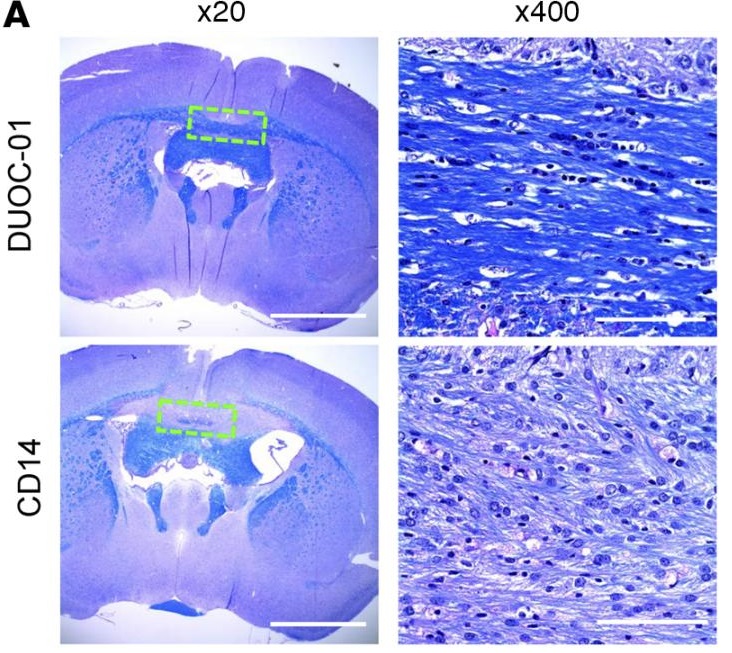 LFB-PAS staining analysis of effect of DUOC-01 treatment on remyelination following cessation of cuprizone (CPZ) treatment.  LFB-PAS staining 1 week after intracranial injection of CD14+ monocytes (lower panels), and DUOC-1 cells (middle panels), in CPZ-fed NSG mice. Midline corpus callosum (CC) area is shown by dotted green line. Scale bars: 2,000 μm (×20 magnification) and 100 μm (×400 magnification).  A cord blood monocyte–derived cell therapy product accelerates brain remyelination.  Balber et al 2016.