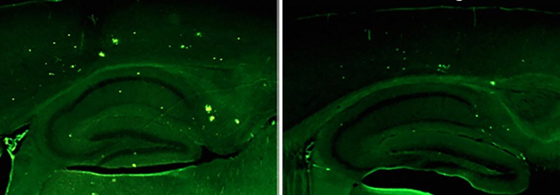 In a mouse model of Alzheimer's disease, Salk Institute researchers show that raising levels of neuregulin-1 (right) lowers a marker of disease pathology in a part of the brain that controls memory compared with controls (left).  Credit: Salk Institute. 