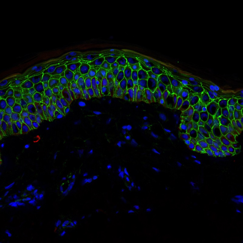 Section of the epidermis showing all its layers, with cell borders in green and cell nuclei in blue.