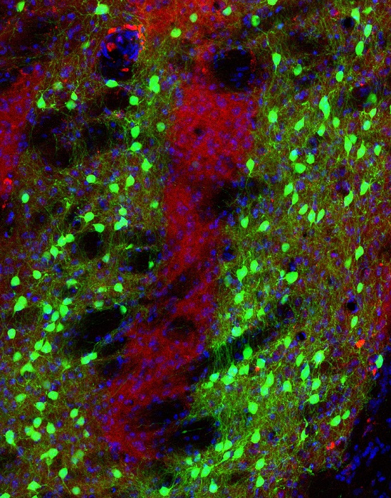 Salk Institute researchers employed novel genetic tools to map the connectivity of neurons within a part of the brain, called the striatum, which controls movement toward a goal or reward. The matrix neurons, highlighted in green, appear to avoid the patch neurons (red), which are smaller clusters of neurons in the striatum. The functions of matrix and patch neurons are still unknown, but the new research will allow scientists to better understand their connections and control the activity of these neurons in future studies.  Credit: Salk Institute. 