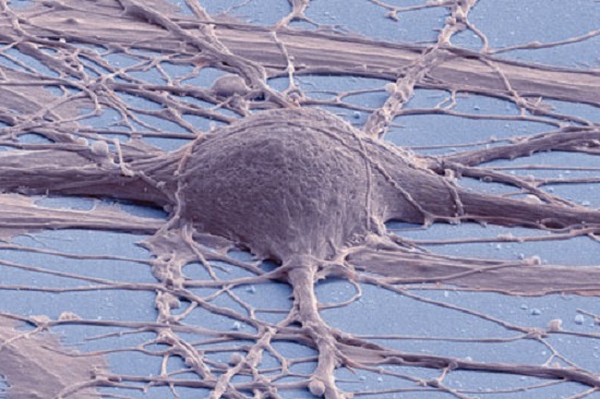 This is a colorized scanning electron micrograph of a human induced pluripotent stem cell-derived neuron in culture.  Credit: Thomas Deerinck, National Center for Microscopy and Imaging Research, UC San Diego. 